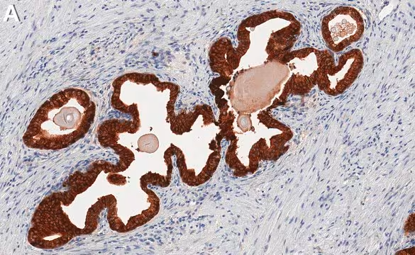 EC 1.1.1.22 structure, CAS 9028-26-6